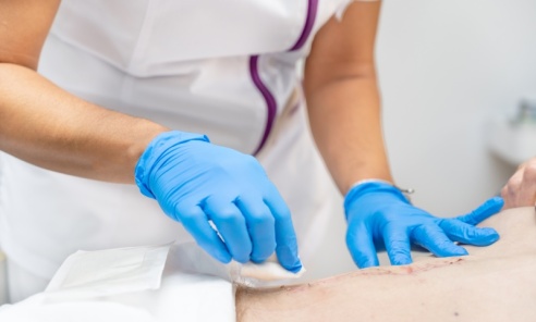 Jak dbać o ranę po zabiegu chirurgicznym? Jak dbać o ranę po zabiegu chirurgicznym? - Serwis informacyjny z Wodzisławia Śląskiego - naszwodzislaw.com